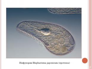 Инфузория Blepharisma japonicum (протозоа)