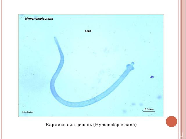 Карликовый цепень (Hymenolepis nana)