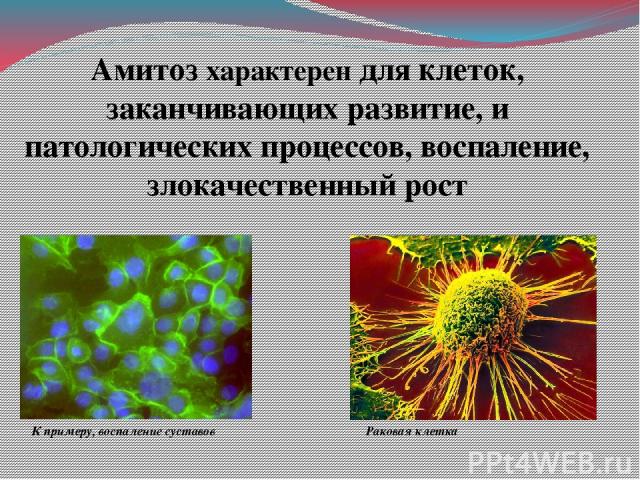 Амитоз характерен для клеток, заканчивающих развитие, и патологических процессов, воспаление, злокачественный рост К примеру, воспаление суставов Раковая клетка