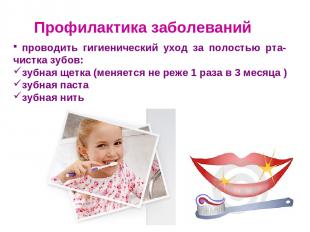 Профилактика заболеваний проводить гигиенический уход за полостью рта- чистка зу