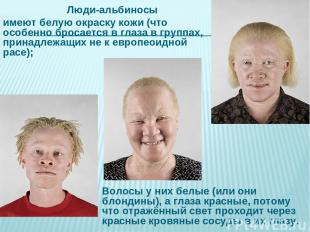 Люди-альбиносы имеют белую окраску кожи (что особенно бросается в глаза в группа