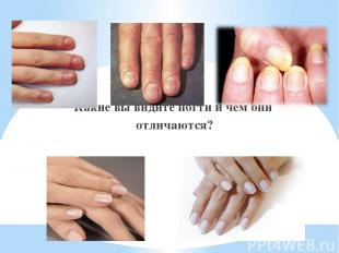 Какие вы видите ногти и чем они отличаются?