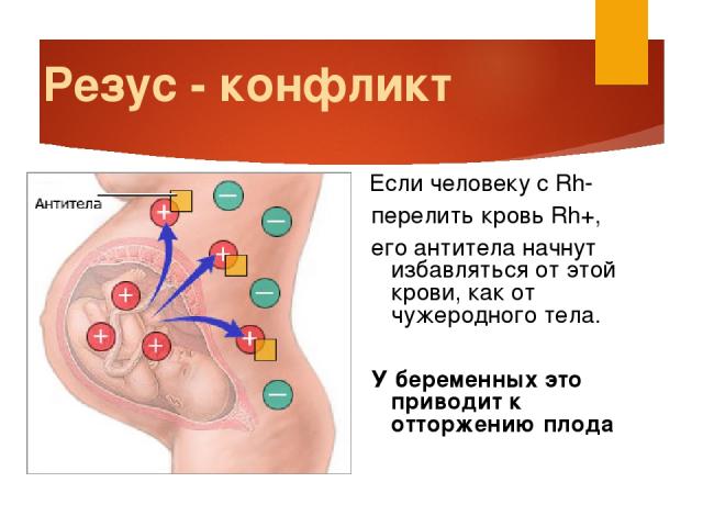 Резус - конфликт Если человеку с Rh- перелить кровь Rh+, его антитела начнут избавляться от этой крови, как от чужеродного тела. У беременных это приводит к отторжению плода