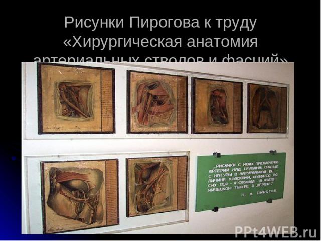Рисунки Пирогова к труду «Хирургическая анатомия артериальных стволов и фасций»