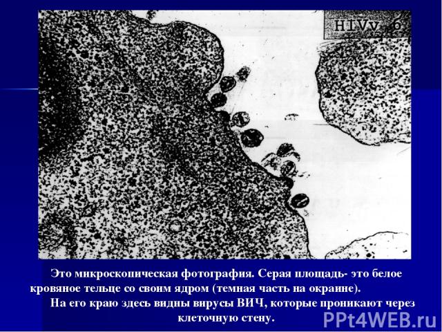 Это микроскопическая фотография. Серая площадь- это белое кровяное тельце со своим ядром (темная часть на окраине). На его краю здесь видны вирусы ВИЧ, которые проникают через клеточную стену.