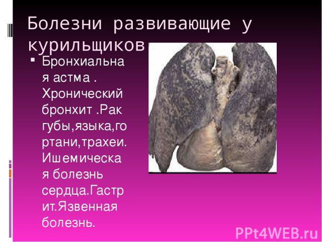 Болезни развивающие у курильщиков. Бронхиальная астма . Хронический бронхит .Рак губы,языка,гортани,трахеи.Ишемическая болезнь сердца.Гастрит.Язвенная болезнь.
