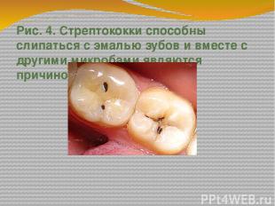 Рис. 4. Стрептококки способны слипаться с эмалью зубов и вместе с другими микроб