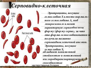 Серповидно-клеточная анемия Эритроциты, несущие гемоглобин S вместо нормаль-ного