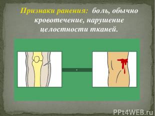 Признаки ранения: боль, обычно кровотечение, нарушение целостности тканей.