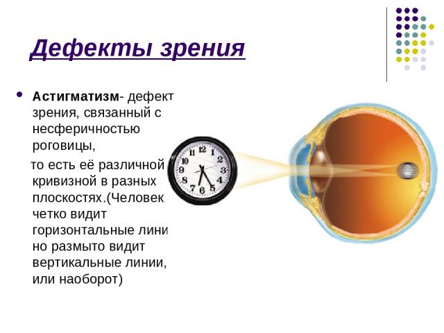 Дефекты зрения Астигматизм- дефект зрения, связанный с несферичностью роговицы, то есть её различной кривизной в разных плоскостях.(Человек четко видит горизонтальные линии, но размыто видит вертикальные линии, или наоборот)