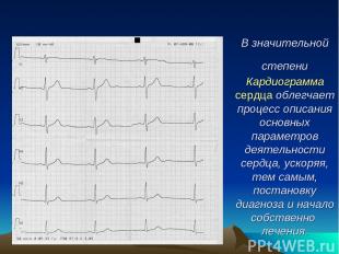 В значительной степени Кардиограмма сердца облегчает процесс описания основных п