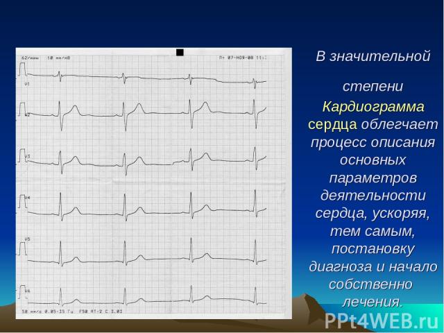 В значительной степени Кардиограмма сердца облегчает процесс описания основных параметров деятельности сердца, ускоряя, тем самым, постановку диагноза и начало собственно лечения.