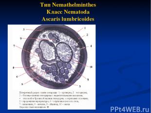 Тип Nemathelminthes Класс Nematoda Ascaris lumbricoides