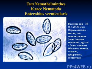 Тип Nemathelminthes Класс Nematoda Enterobius vermicularis Размеры яиц 50-60 х 2