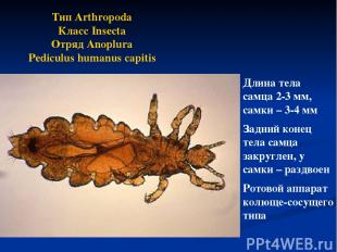 Тип Arthropoda Класс Insecta Отряд Anoplura Pediculus humanus capitis Длина тела