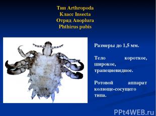 Тип Arthropoda Класс Insecta Отряд Anoplura Phthirus pubis Размеры до 1,5 мм. Те