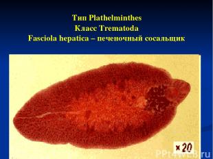 Тип Plathelminthes Класс Trematoda Fasciola hepatica – печеночный сосальщик