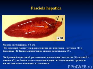 Fasciola hepatica Форма листовидная, 3-5 см. На передней части тела расположены