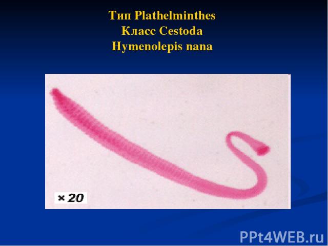 Тип Plathelminthes Класс Cestoda Hymenolepis nana