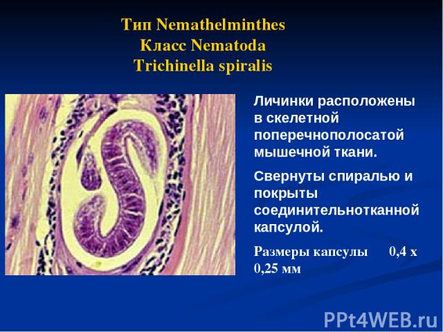 Тип Nemathelminthes Класс Nematoda Trichinella spiralis Личинки расположены в скелетной поперечнополосатой мышечной ткани. Свернуты спиралью и покрыты соединительнотканной капсулой. Размеры капсулы 0,4 х 0,25 мм
