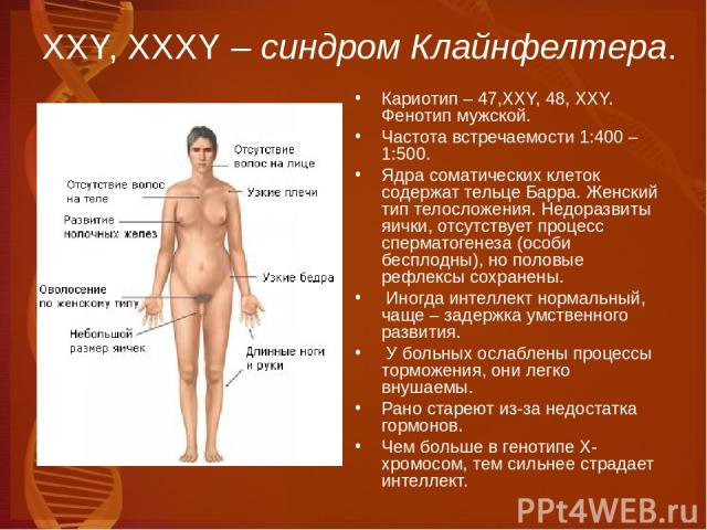 ХХY, XXXY – синдром Клайнфелтера. Кариотип – 47,XXY, 48, XXY. Фенотип мужской. Частота встречаемости 1:400 – 1:500. Ядра соматических клеток содержат тельце Барра. Женский тип телосложения. Недоразвиты яички, отсутствует процесс сперматогенеза (особ…