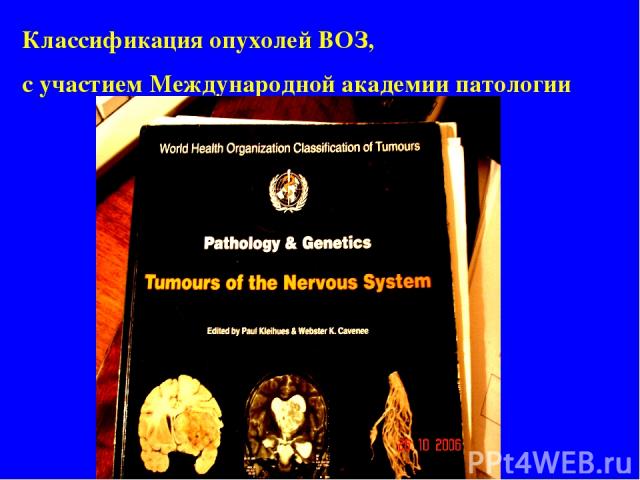 Классификация опухолей ВОЗ, с участием Международной академии патологии