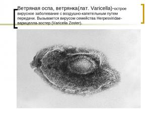 Ветряная оспа, ветрянка(лат. Varicella)-острое вирусное заболевание с воздушно-к