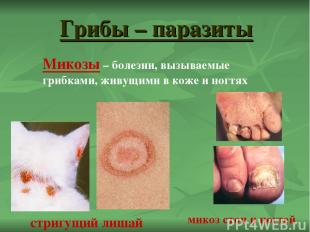 Грибы – паразиты стригущий лишай микоз стоп и ногтей Микозы – болезни, вызываемы