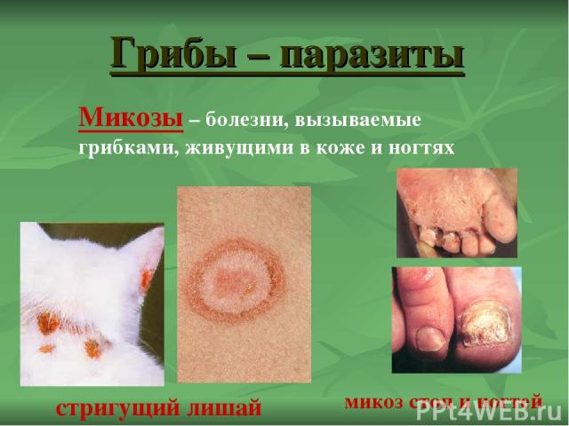 Грибы – паразиты стригущий лишай микоз стоп и ногтей Микозы – болезни, вызываемые грибками, живущими в коже и ногтях