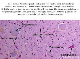 This is a Nissl stained preparation of spinal cord ventral horn. Several large m