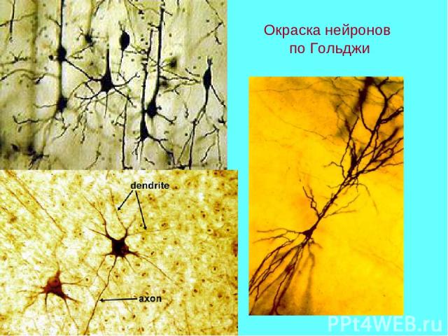 Окраска нейронов по Гольджи