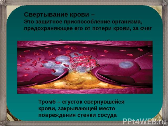 Свертывание крови – Это защитное приспособление организма, предохраняющее его от потери крови, за счет образования тромба Тромб – сгусток свернувшейся крови, закрывающей место повреждения стенки сосуда