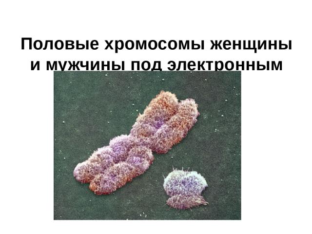 Половые хромосомы женщины и мужчины под электронным микроскопом