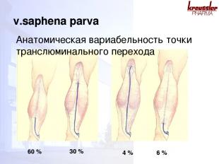 60 % 30 % 4 % 6 % v.saphena parva Анатомическая вариабельность точки транслюмина