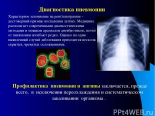 Характерное затемнение на рентгенограмме - достоверный признак воспаления легких