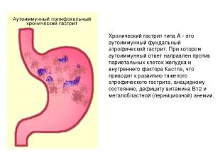 Дисплазия желудка фото