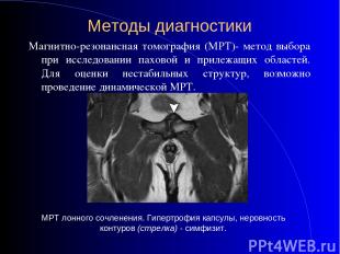 Методы диагностики Магнитно-резонансная томография (МРТ)- метод выбора при иссле