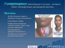 Гипертиреоз щитовидной железы