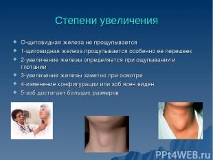 Степени увеличения О-щитовидная железа не прощупывается 1-щитовидная железа прощ