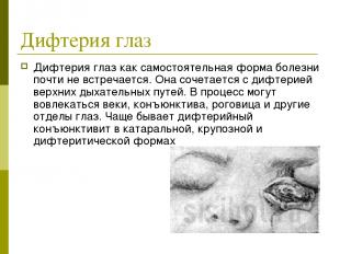 Дифтерия глаз Дифтерия глаз как самостоятельная форма болезни почти не встречает