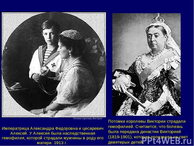 Потомки королевы Виктории страдали гемофилией. Считается, что болезнь была передана династии Викторией (1819-1901), которая произвела на свет девятерых детей.                                                                                           …