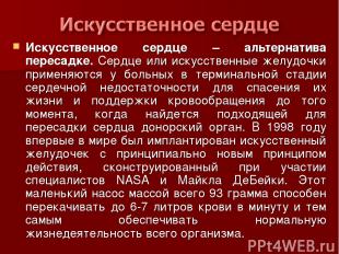 Искусственное сердце – альтернатива пересадке. Сердце или искусственные желудочк