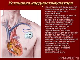 На сегодняшний день имеется совершенно новое поколение данного устройства – трех