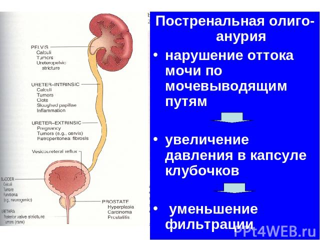 prostatitis infúziós magok petrezselyem A prostatitis urethritis tablettái