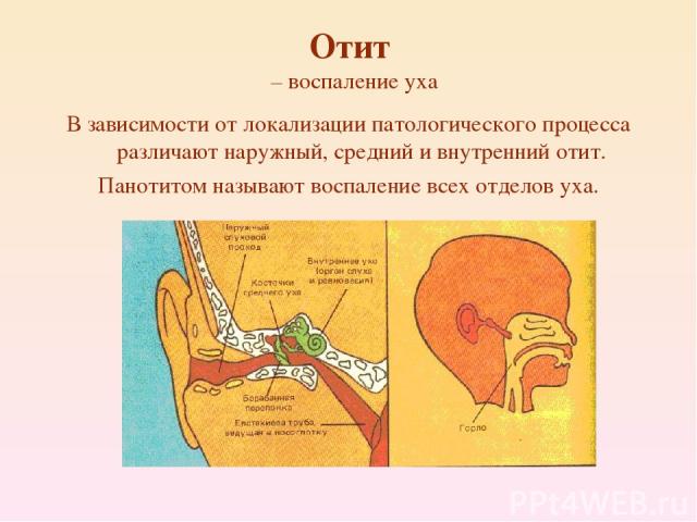 Отит – воспаление уха В зависимости от локализации патологического процесса различают наружный, средний и внутренний отит. Панотитом называют воспаление всех отделов уха.