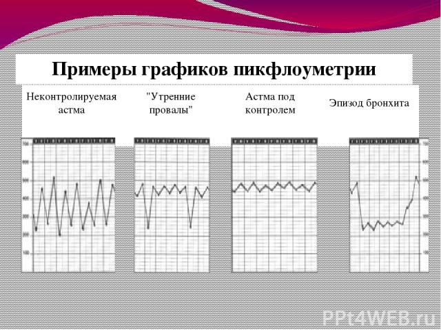 Примеры графиковпикфлоуметрии Неконтролируемая астма 