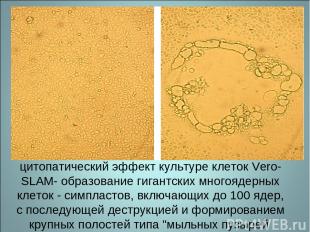 цитопатический эффект культуре клеток Vero-SLAM- образование гигантских многояде
