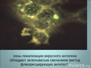 зоны локализации вирусного антигена обладают зеленоватым свечением (метод флюоре