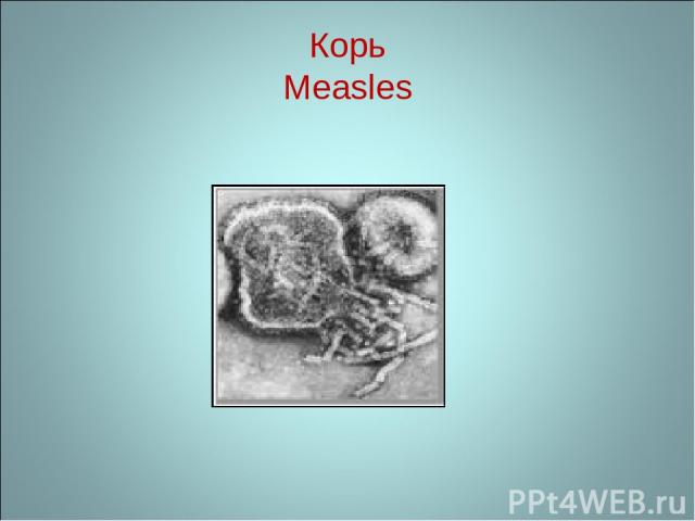 Корь Measles
