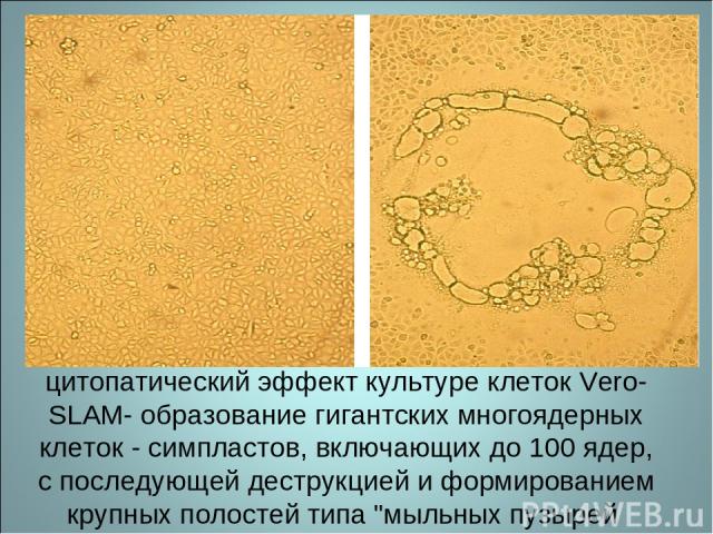 цитопатический эффект культуре клеток Vero-SLAM- образование гигантских многоядерных клеток - симпластов, включающих до 100 ядер, с последующей деструкцией и формированием крупных полостей типа 